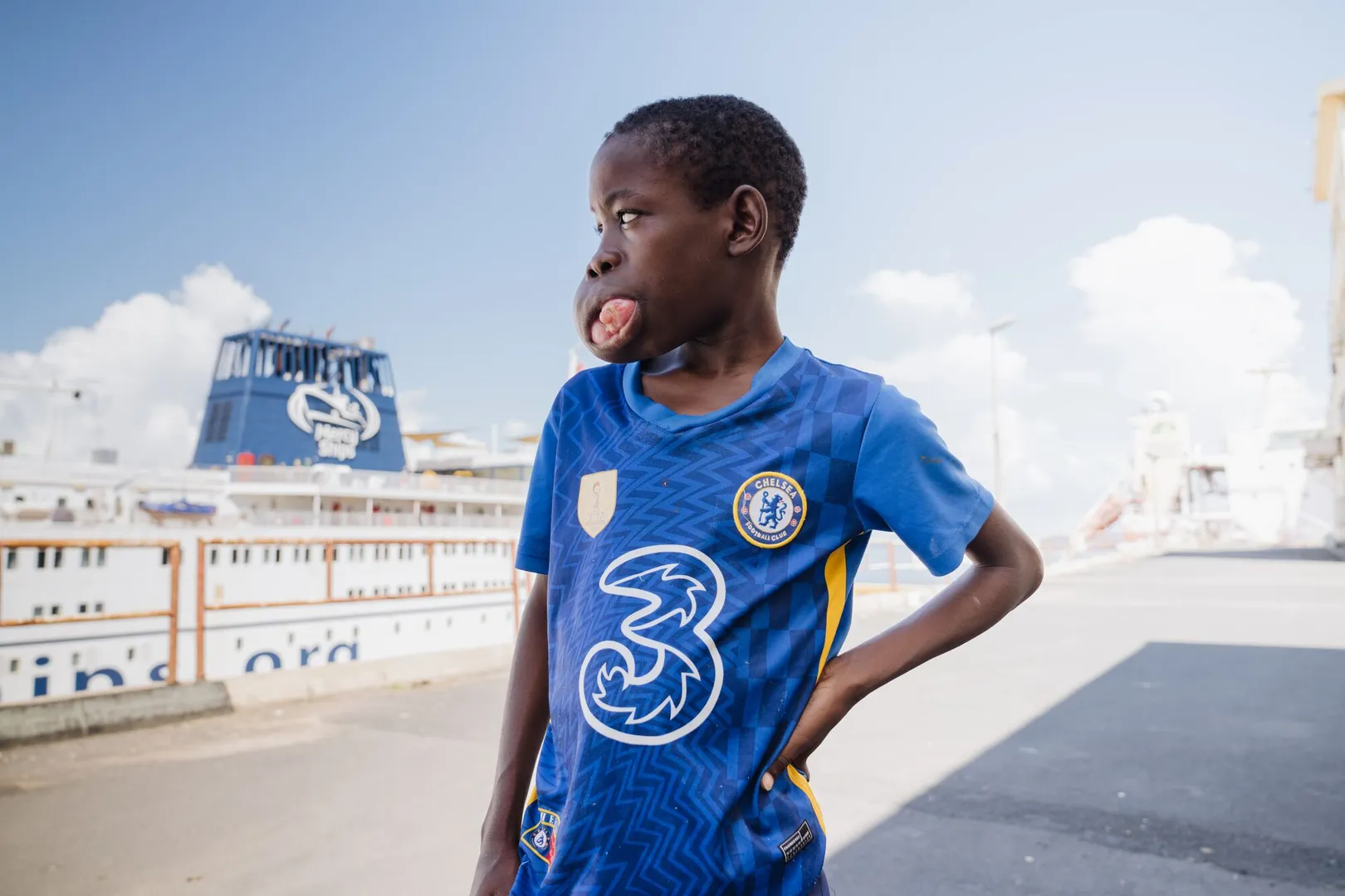 Un garçon de 13 ans, en difficulté pour manger et parler à cause d'une tumeur, bénéficie d'une intervention chirurgicale qui va transformer sa vie au Sénégal