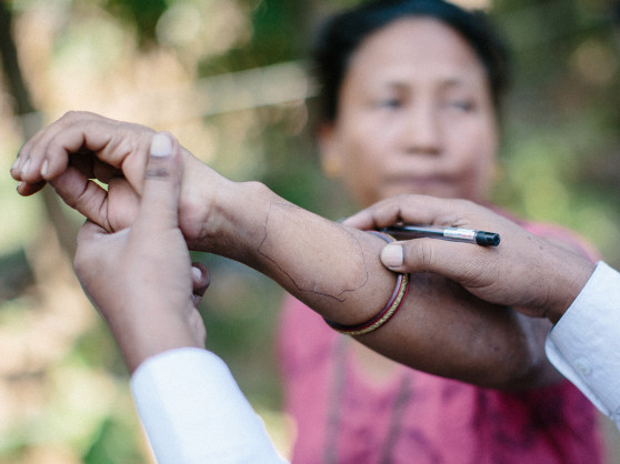 Novartis renews WHO medicine donation pledge with aim of ending leprosy