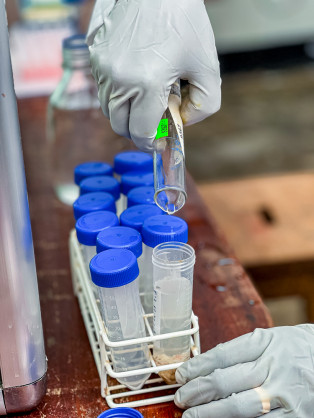 African Development Bank Group funds regional health resilience drive in Southern Africa